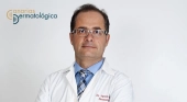 “Se estima que en 2040 el cáncer de piel se convierta en el segundo tipo de tumor en incidencia global” | En la imagen, Doctor Agustín Viera, dermatólogo.